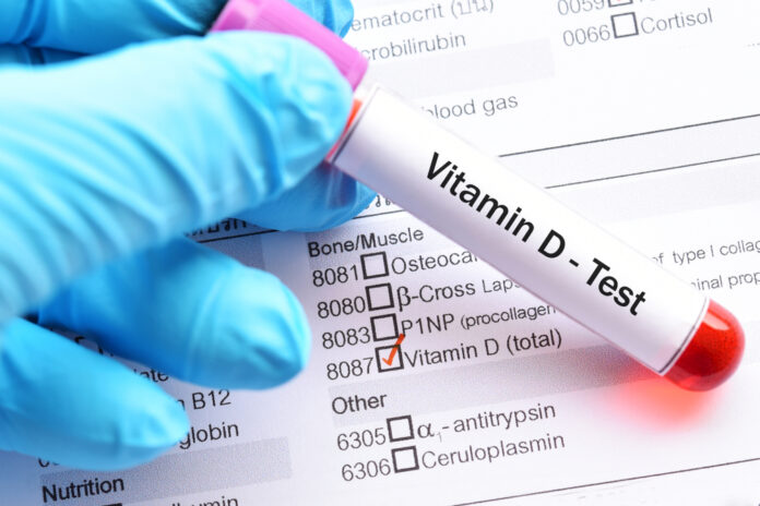 Vitamin-D-Selbsttest Vorteile und Nachteile von Teststreifen und Labortests im Vergleich