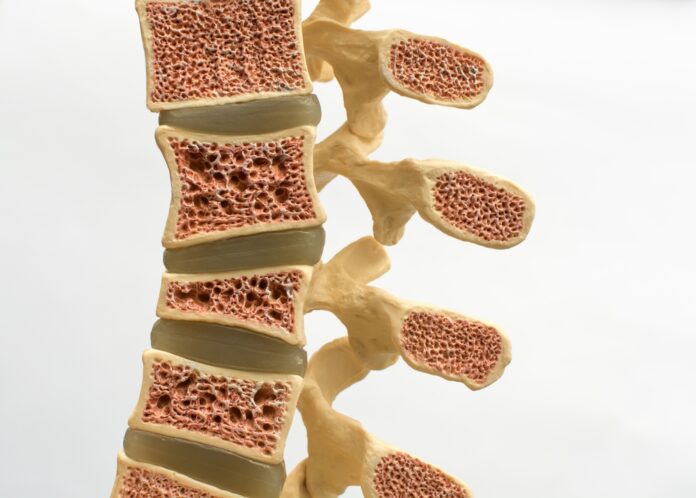 Ratgeber Osteoporose Symptome erkennen und rechtzeitig behandeln – So schützen Sie Ihre Knochengesundheit Ratgeber Osteoporose Symptome erkennen und rechtzeitig behandeln – So schützen Sie Ihre Knochengesundheit